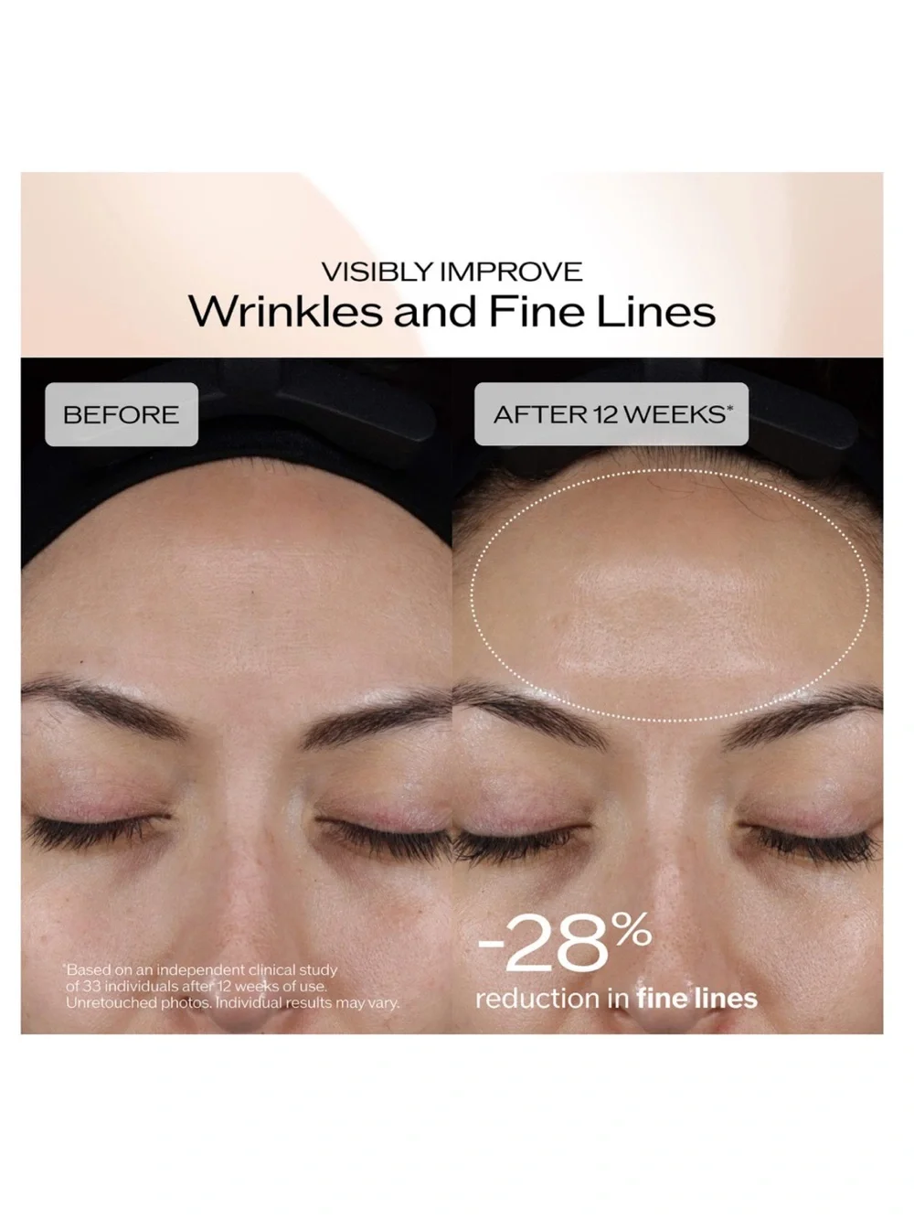 Shiseido Benefiance Dark Spot & Wrinkle Smoothing Serum NIB